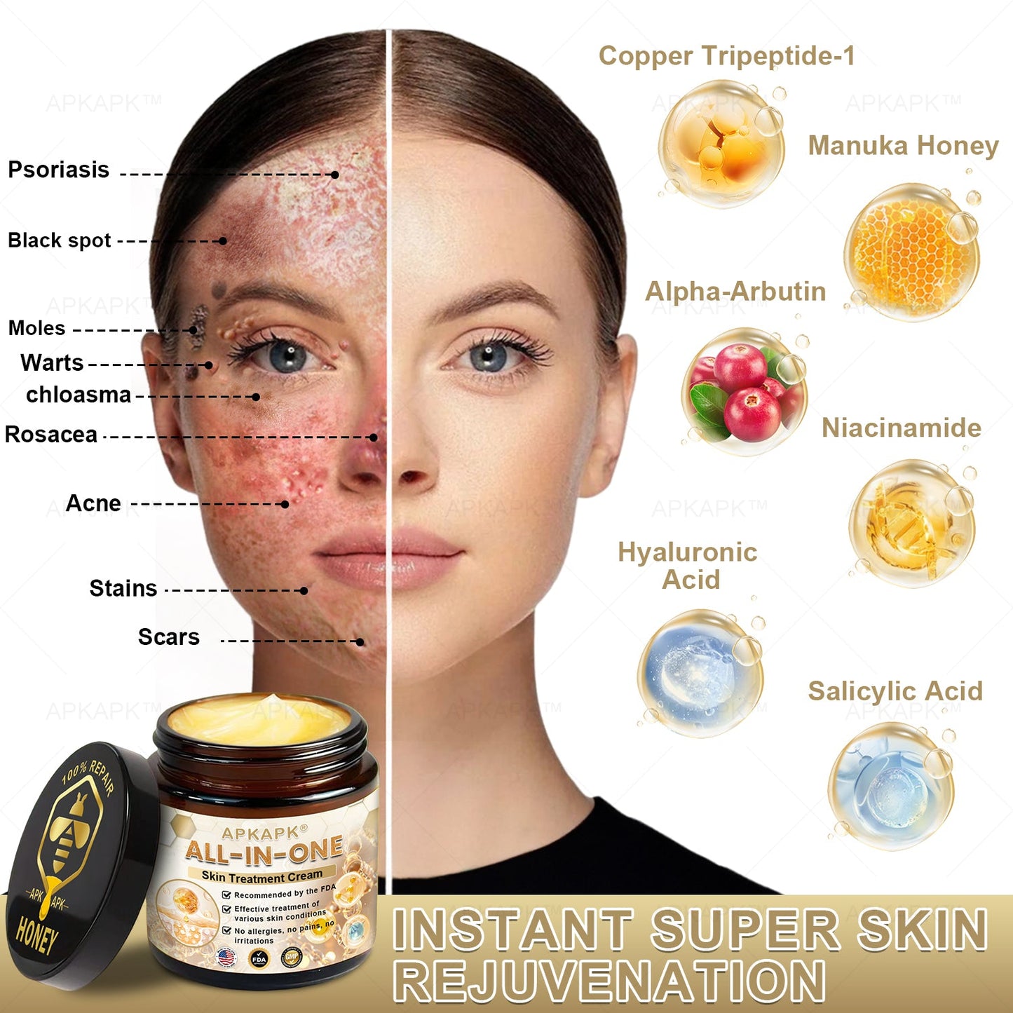 2025 Readers' Choice Award Winner🥇𝐀𝐏𝐊𝐀𝐏𝐊™ 𝐄𝐟𝐟𝐞𝐜𝐭𝐢𝐯𝐞 𝐀𝐥𝐥-𝐢𝐧-𝐎𝐧𝐞 𝐒𝐤𝐢𝐧 𝐓𝐫𝐞𝐚𝐭𝐦𝐞𝐧𝐭 𝐂𝐫𝐞𝐚𝐦 (AAD Recommended)