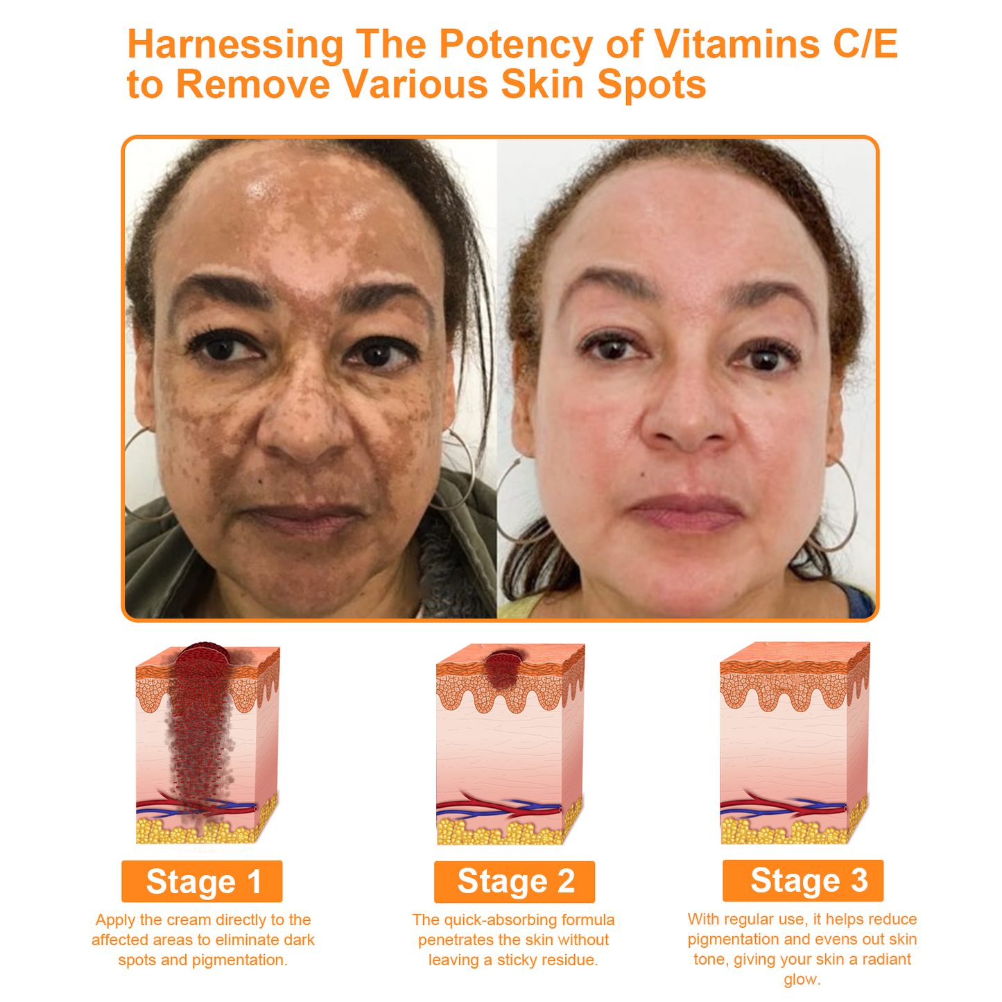 2025 Readers' Choice Award Winner🥇𝐀𝐏𝐊𝐀𝐏𝐊™ 𝐄𝐟𝐟𝐞𝐜𝐭𝐢𝐯𝐞 𝐀𝐥𝐥-𝐢𝐧-𝐎𝐧𝐞 𝐒𝐤𝐢𝐧 𝐓𝐫𝐞𝐚𝐭𝐦𝐞𝐧𝐭 𝐂𝐫𝐞𝐚𝐦 (AAD Recommended)