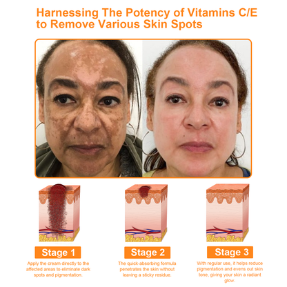 2025 Readers' Choice Award Winner🥇𝐀𝐏𝐊𝐀𝐏𝐊™ 𝐄𝐟𝐟𝐞𝐜𝐭𝐢𝐯𝐞 𝐀𝐥𝐥-𝐢𝐧-𝐎𝐧𝐞 𝐒𝐤𝐢𝐧 𝐓𝐫𝐞𝐚𝐭𝐦𝐞𝐧𝐭 𝐂𝐫𝐞𝐚𝐦 (AAD Recommended)